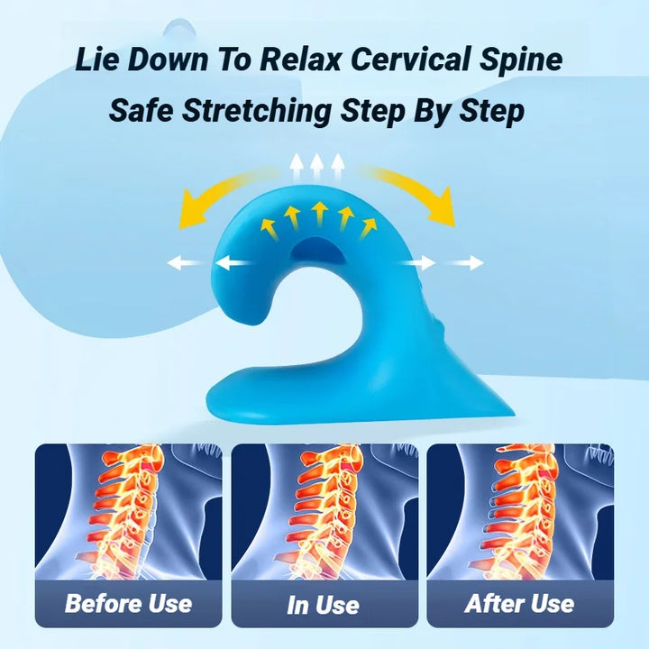 PostureAlign Neck Stretcher